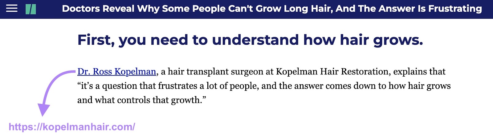 Digital PR article by Kopelman Hair Restoration on Huffpost highlighting their expertise and offerings along with a link back to their site.